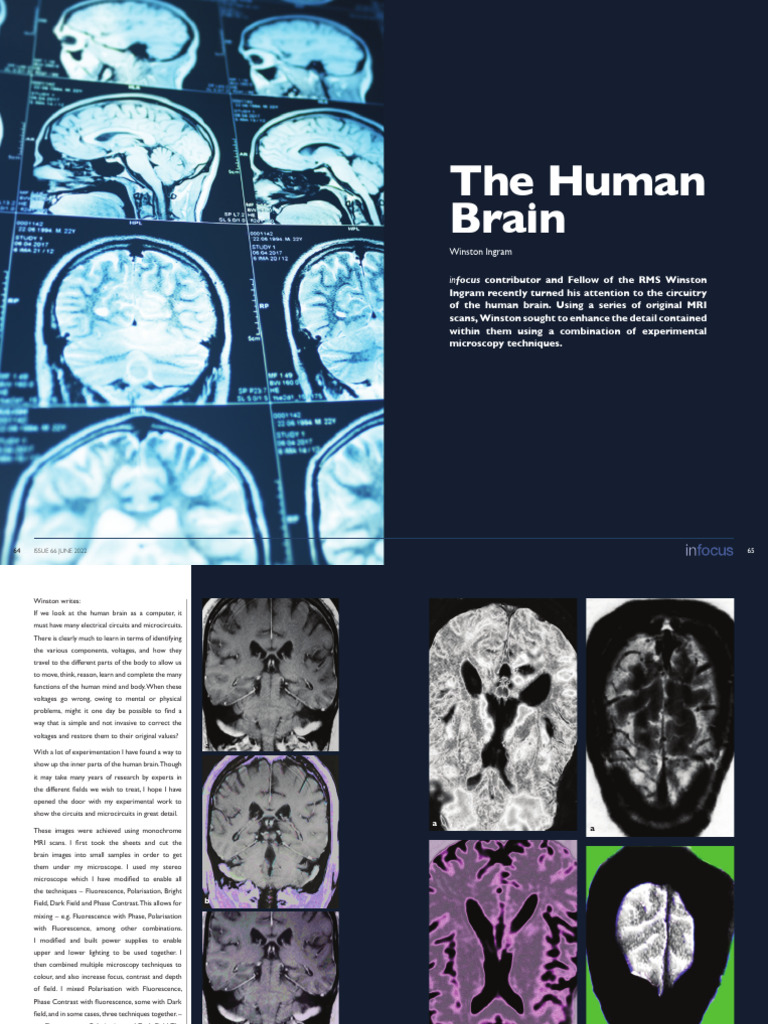 Enhancing MRI Scans of the Human Brain | PDF | Microscopy | Brain