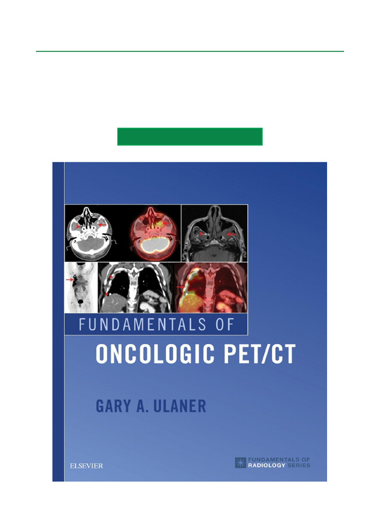 Oncologic PET/CT Fundamentals Guide | PDF | Positron Emission ...