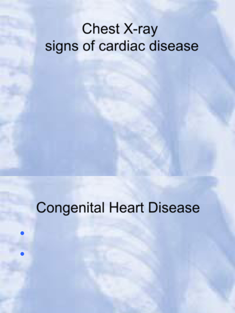 Chest X-ray Signs of Cardiac Disease | PDF | Heart | Congenital Heart ...