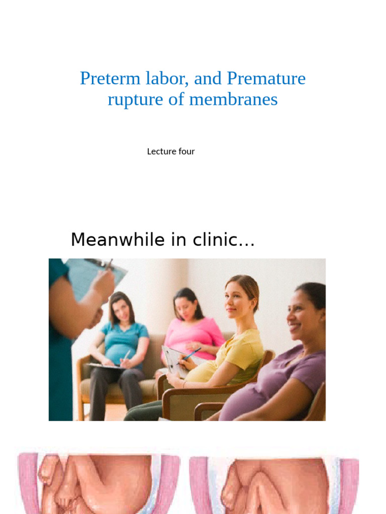 Preterm Labor and Rupture of Membare Lecture 3 | PDF | Preterm Birth ...