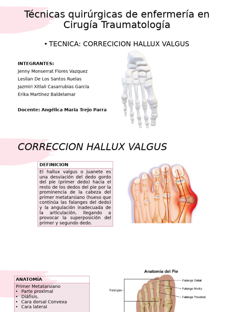 Técnicas de Corrección de Hallux Valgus | PDF | Dedo del pie ...