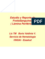 Estudio y Reporte de Frotis Sanguíneo (Lámina Periférica