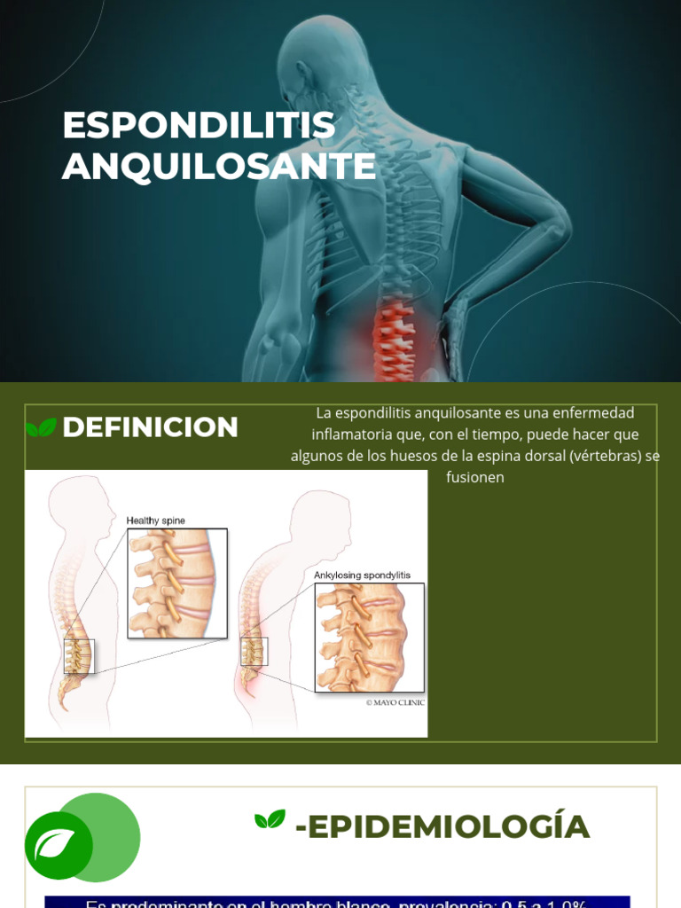 Espondilitis Anquilosante | PDF | La columna vertebral | Especialidades ...