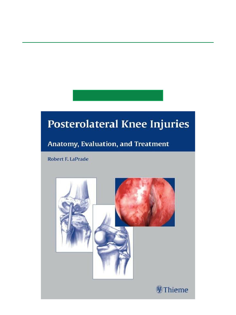 Posterolateral Knee Injuries Anatomy, Evaluation, and Treatment 1st ...