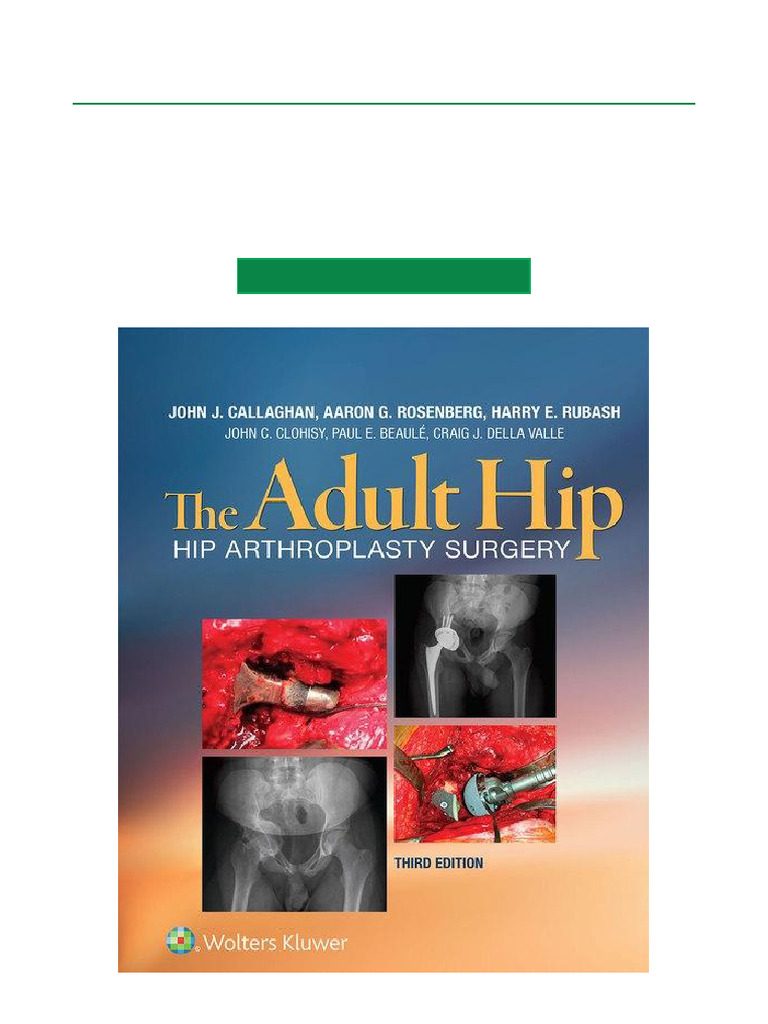 Adult Hip Arthroplasty Surgery Guide | PDF | Orthopedic Surgery