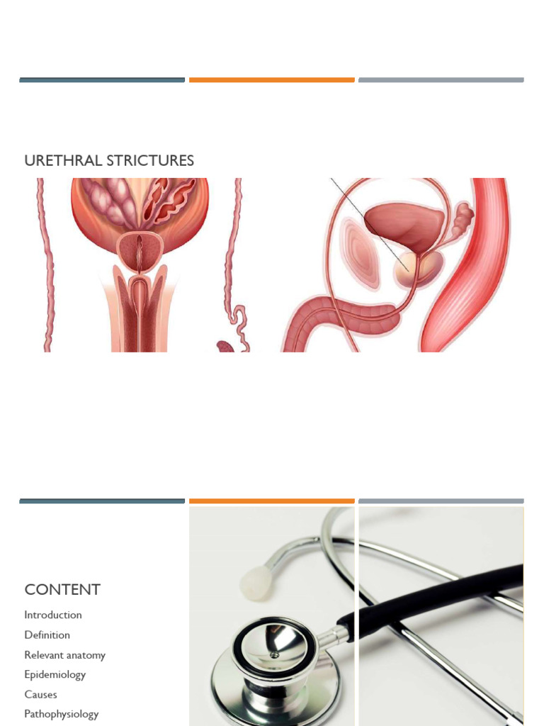 Urethral Strictures: Causes and Management | PDF | Mammal Reproductive ...