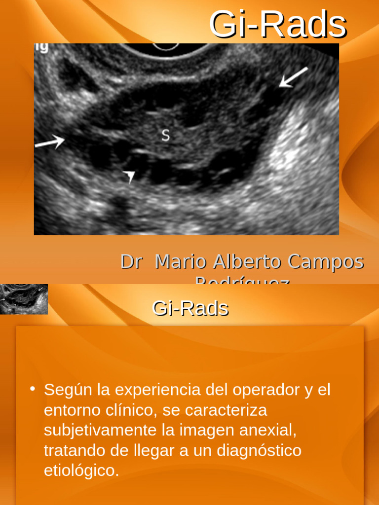 Clasificación Gi-RADS en Imágenes Anexiales | PDF | Ovario | Sistema ...
