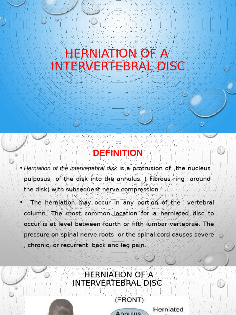 Herniation of A Intervertebral Disc | PDF | Diseases And Disorders ...