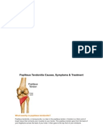 Popliteal Tendinitis