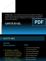 Cancer Bucal