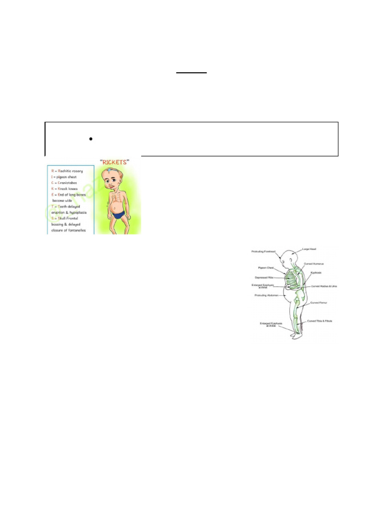 Understanding Rickets in Children | PDF