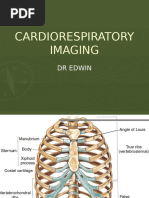Chest X-Ray Anatomy and Positioning Guide | PDF | Thorax | Lung
