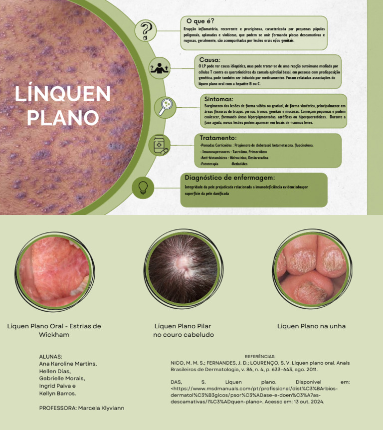 Diagnóstico e Tratamento do Líquen Plano | PDF | Dermatologia | Pele