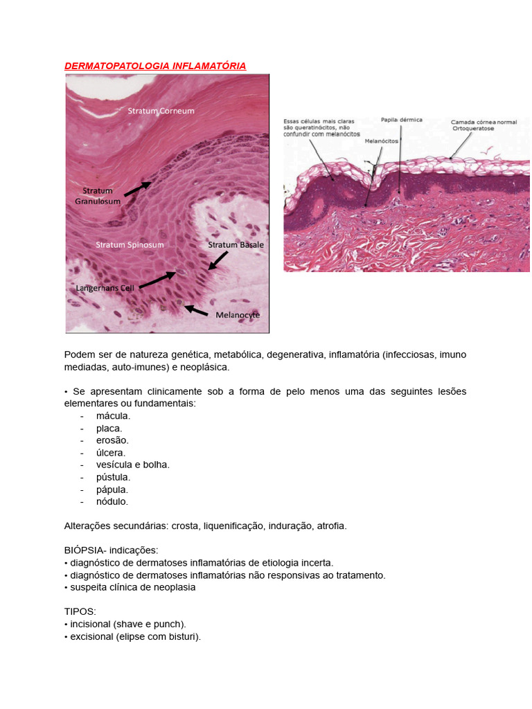 Dermatopatologia Inflamatória: Tipos e Diagnóstico | PDF | Célula T ...