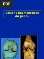 Laxité chronique du genou et traitement | PDF | Genou | Articulation ...