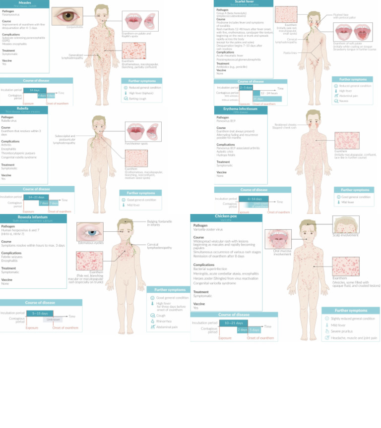 Childhood exanthems PDF