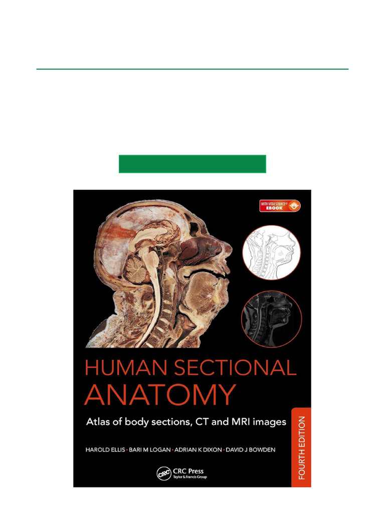 Human Sectional Anatomy Atlas Download | PDF | Ct Scan | Magnetic ...