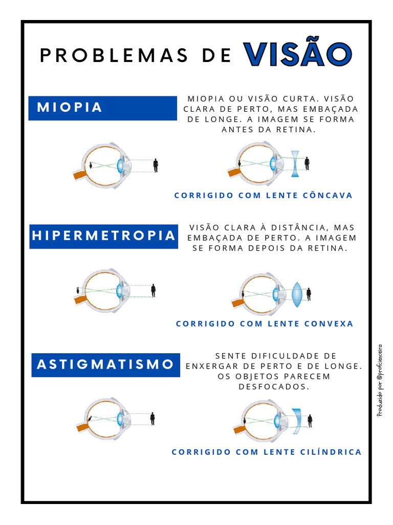 Problemas de Visão: Miopia e Astigmatismo | PDF