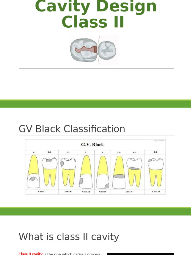 Class II | PDF | Tooth Enamel | Dentistry