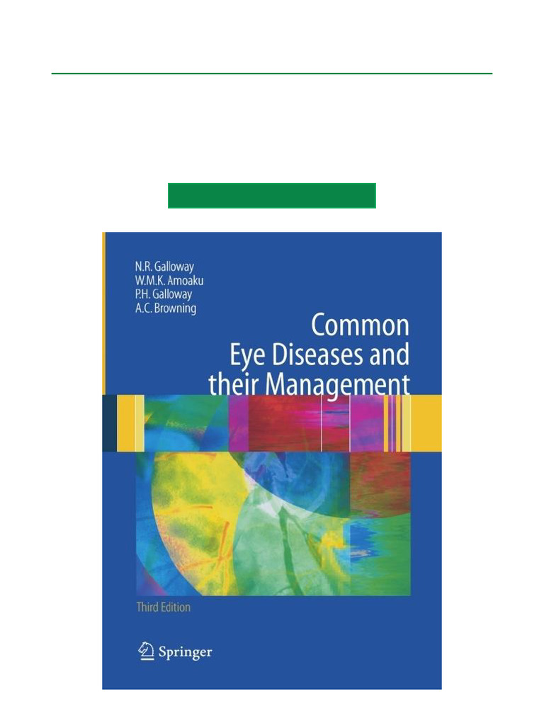 Common Eye Diseases: Management Guide | PDF | Retina | Cornea