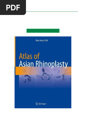 健康・医学 atlas of asian rhinoplasty Atlas of Asian Rhinoplasty: 9789811086441: Medicine & Health