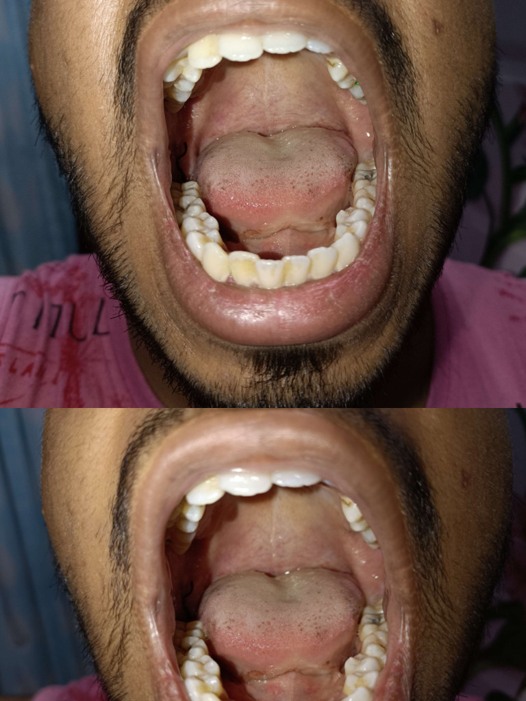 Tooth Doc 1 | PDF