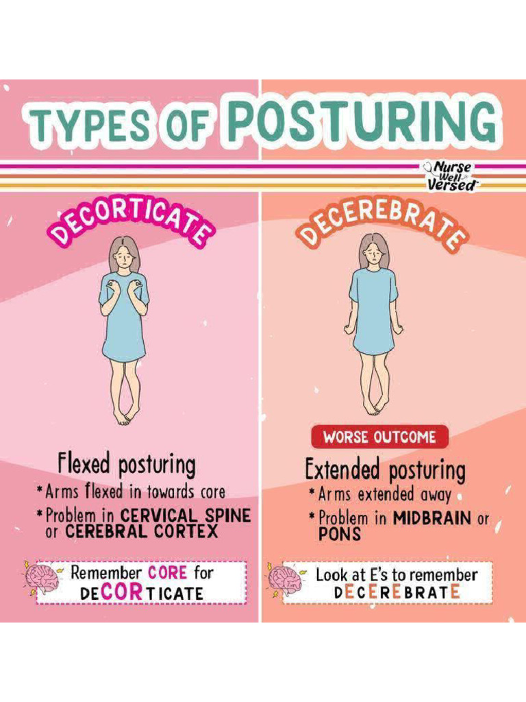 Types of Posturing | PDF