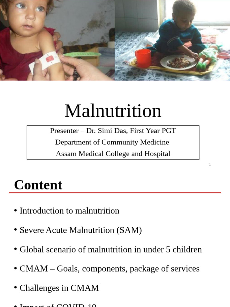 Community Management of Acute Malnutrition | PDF | Malnutrition | Nutrition