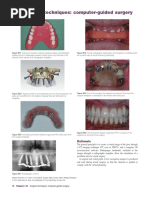 10509_neodent_easyguide_manual_en_eU_A00_of_250521 | PDF | Dental ...