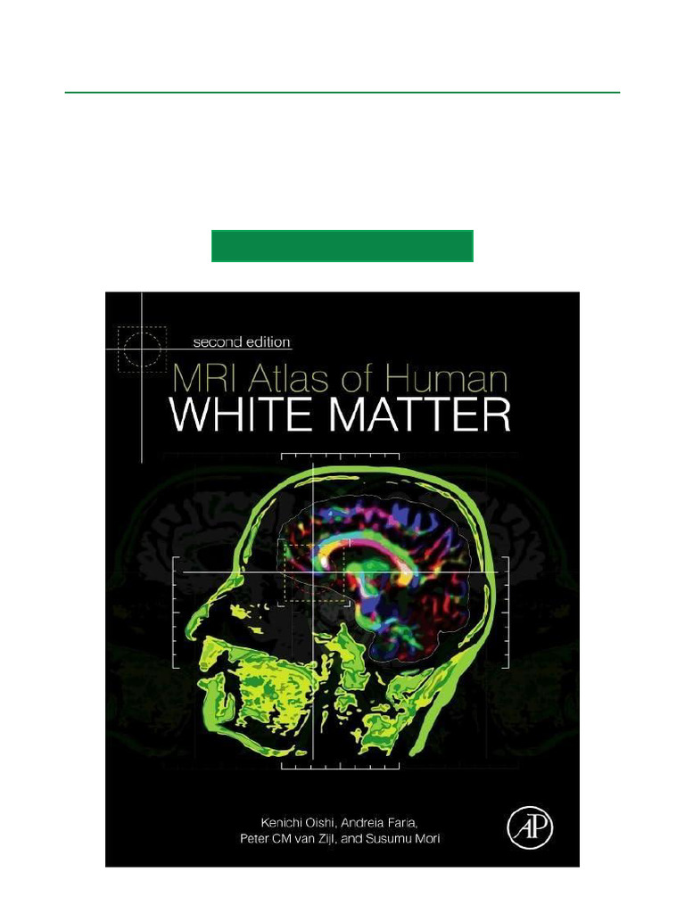 MRI Atlas of Human White Matter | PDF
