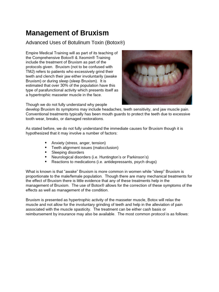 Management of Bruxism | PDF | Botulinum Toxin | Diseases And Disorders