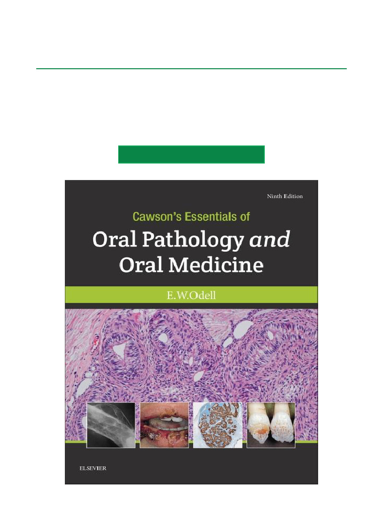 Cawson's Oral Pathology 9th Edition PDF | PDF | Human Tooth | Lymphoma