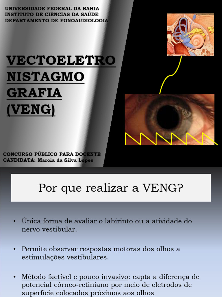 Provas Vestibulares e Oculomotoras Na Vestibulomentria | PDF | Sistema ...