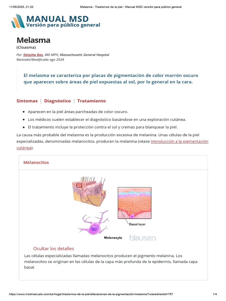 Melasma - Trastornos de La Piel - Manual MSD Versión para Público ...