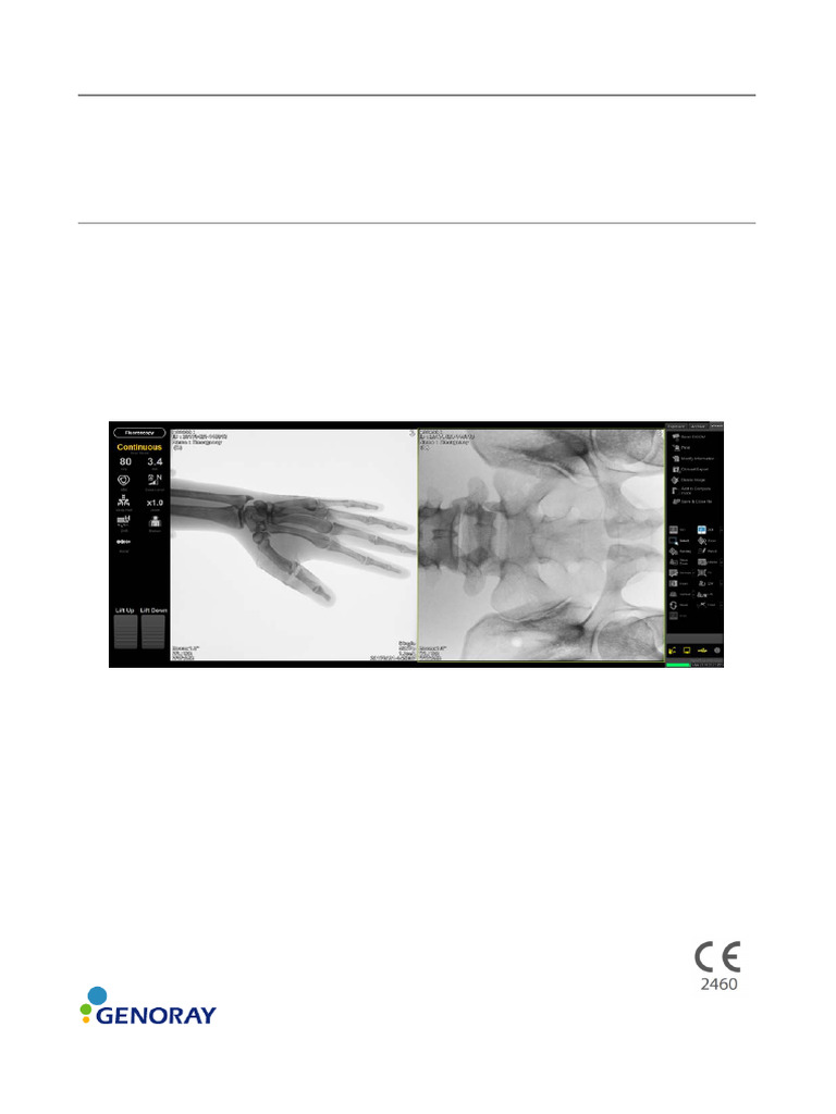 (ZENIS (OSCAR Series) User's Manual Eng Ver1.1 - CE 2460 | PDF | Cursor ...
