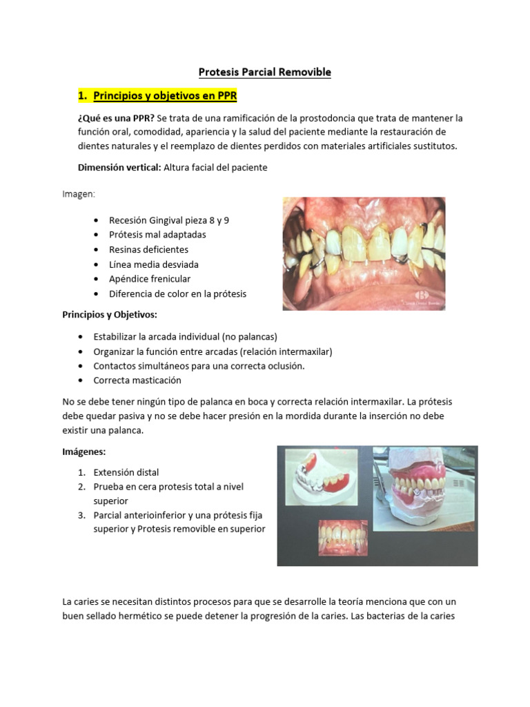 Protesis Parcial Removible | PDF | Conector eléctrico | Odontología