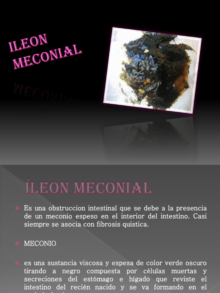 Ileon Meconial | PDF | Heces | Páncreas