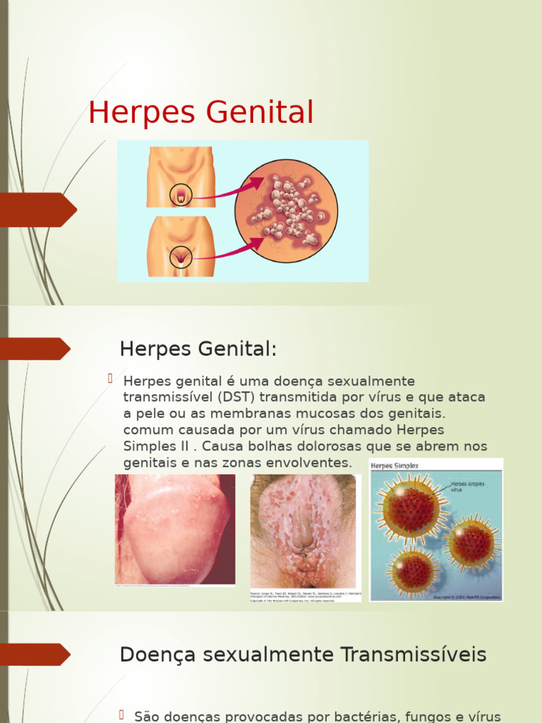 Herpes Genital | PDF