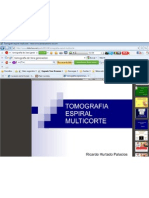 Tomografia Espiral Multicorte