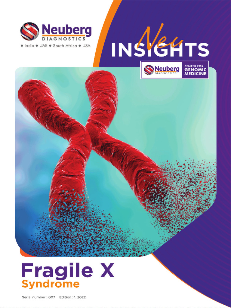 07 Fragile X Syndrome - Compressed | PDF