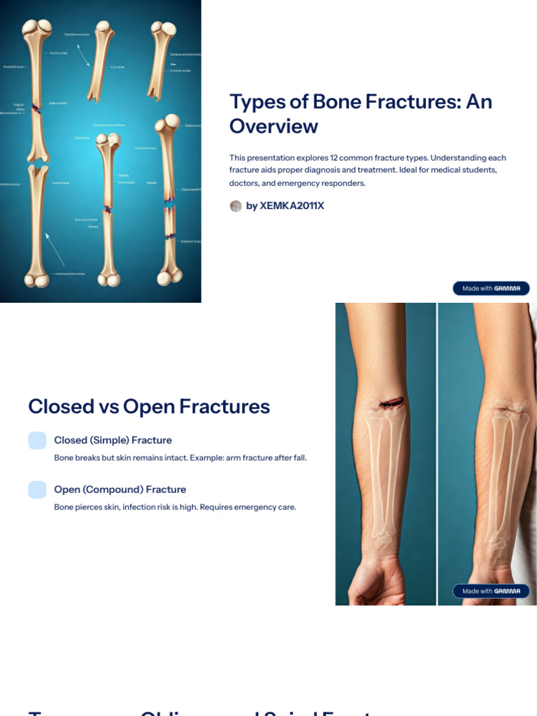 Overview of Bone Fracture Types | PDF