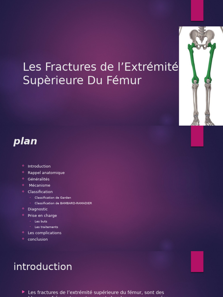 Les Fractures de l’Extrémité Supèrieure Du Fémur | PDF | Maladies et ...