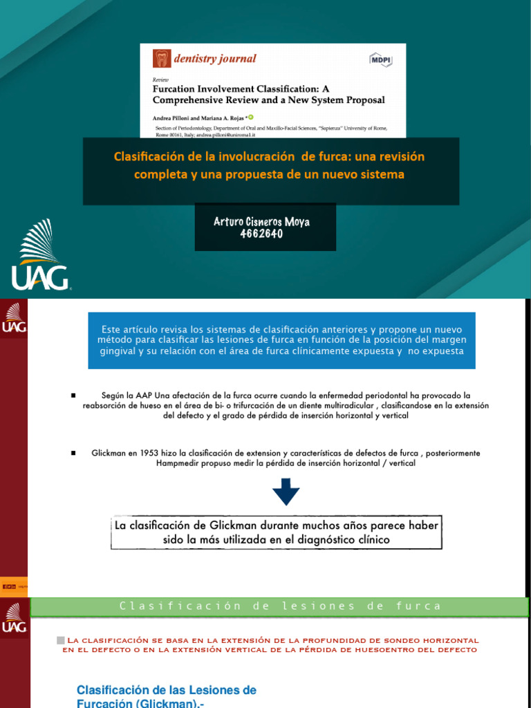 Nueva clasificación de lesiones de furca | PDF | Hueso | Especialidades ...