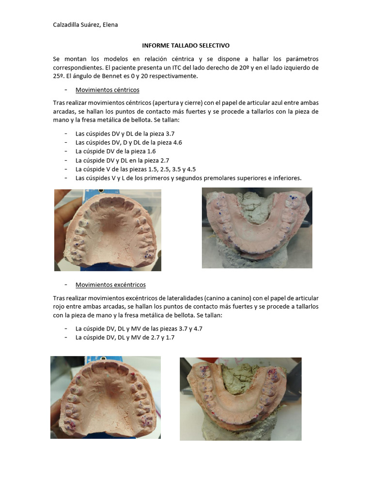 Informe de Tallado Selectivo Dental | PDF