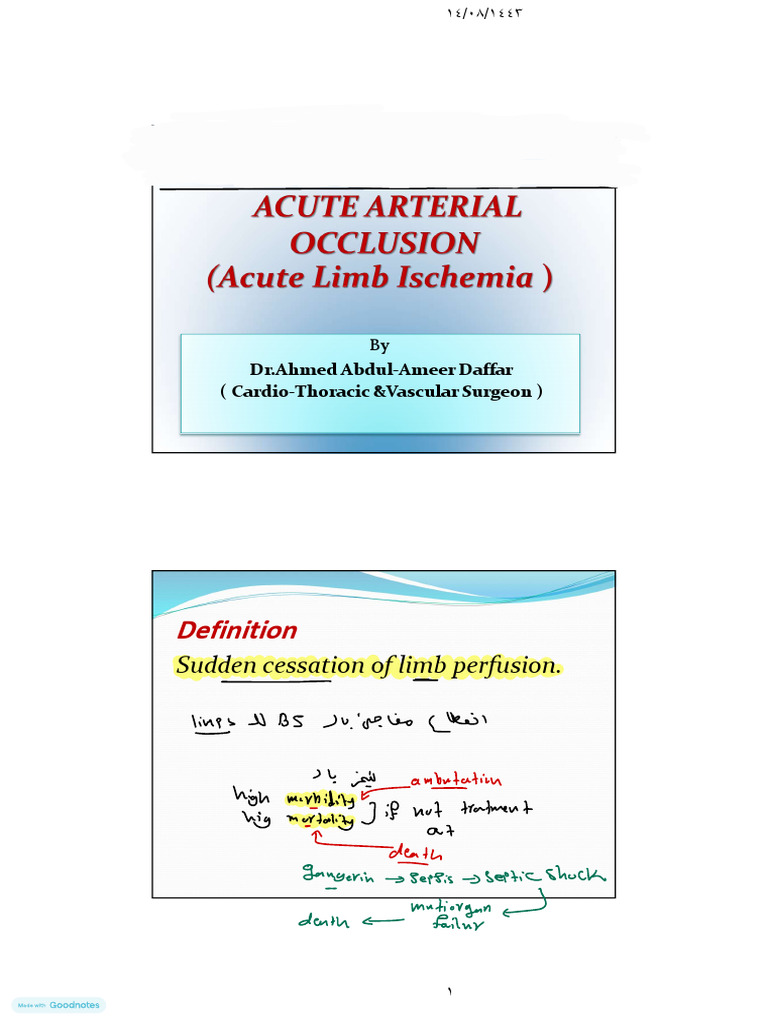 Acute Limb Ischemia | PDF