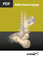 TightRope ABS Button System Overview | PDF | Limbs (Anatomy ...