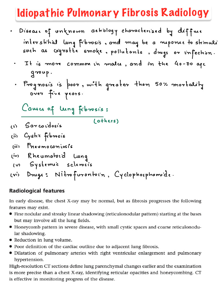 Idiopathic Pulmonary Fibrosis Overview | PDF
