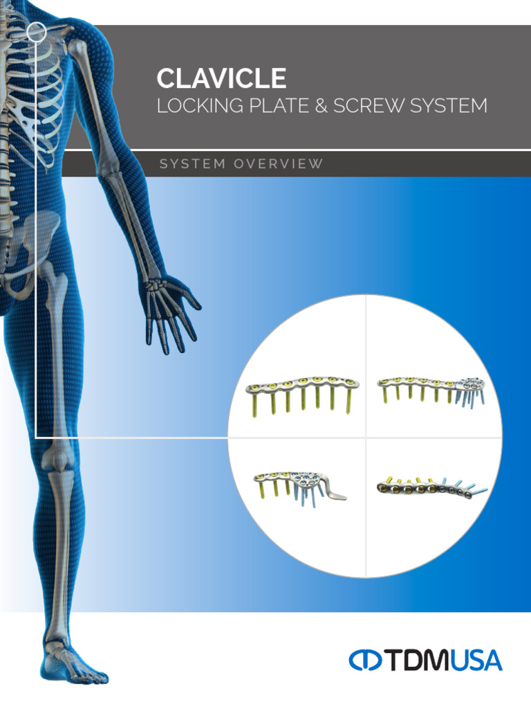 Clavicle Locking Plate System Overview | PDF