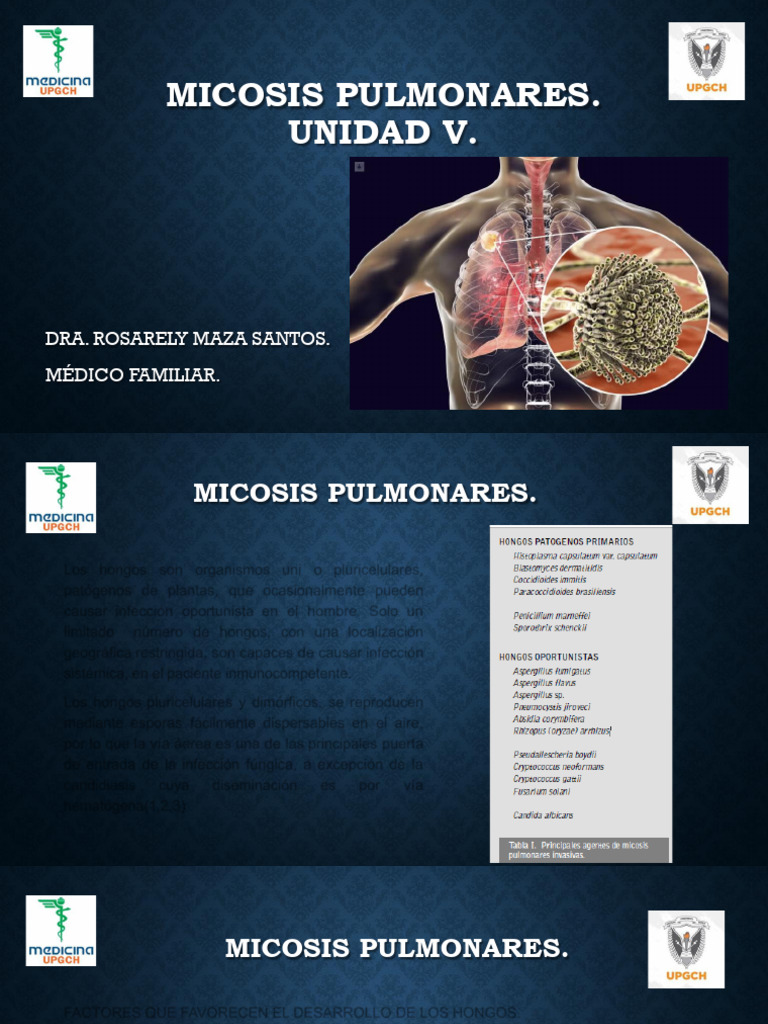 13.- MICOSIS PULMONARES | PDF | Tos | Medicina CLINICA