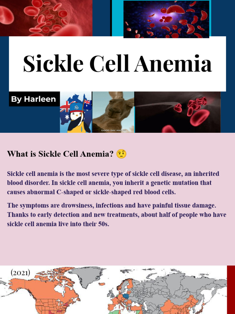Sickle Cell Anemia (1) | PDF